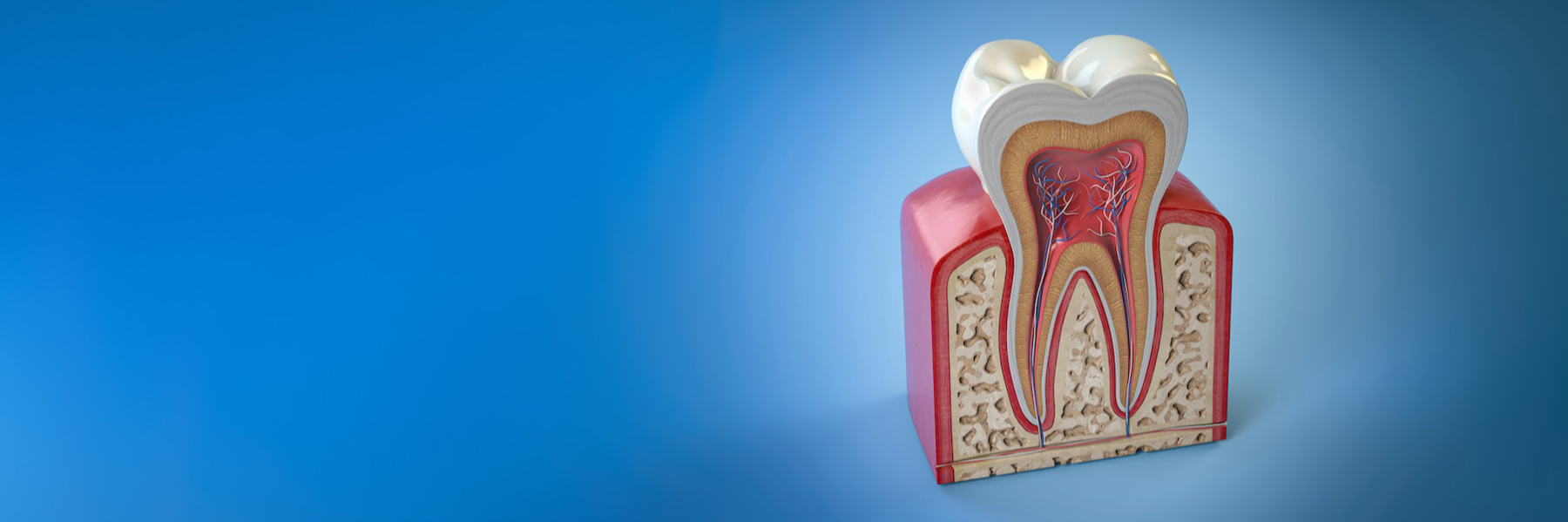 Root Canal Treatment | Dentist