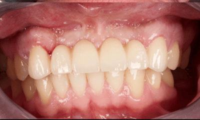 After treatment - A Complete Smile, Restored